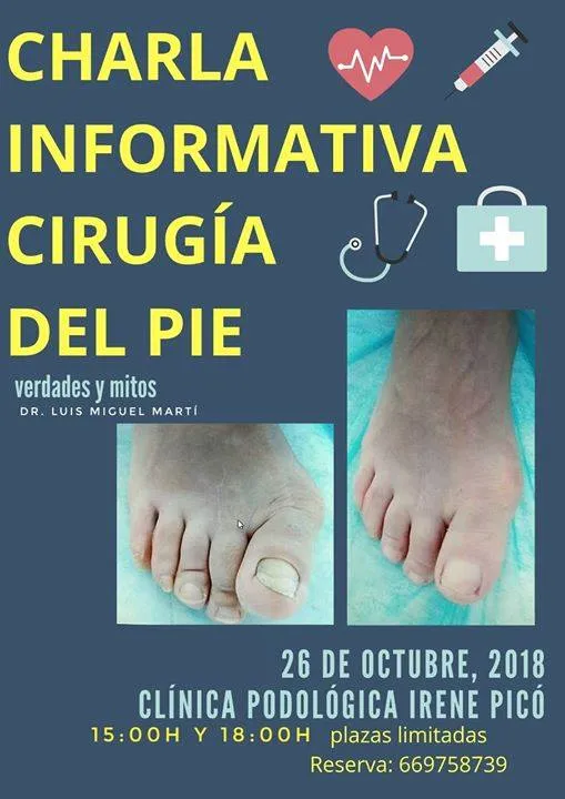 Charla Informativa Gratuita: "Cirugía Del Pie. Verdades Y Mitos"