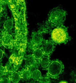 I Jornada de avances en inmunología clínica